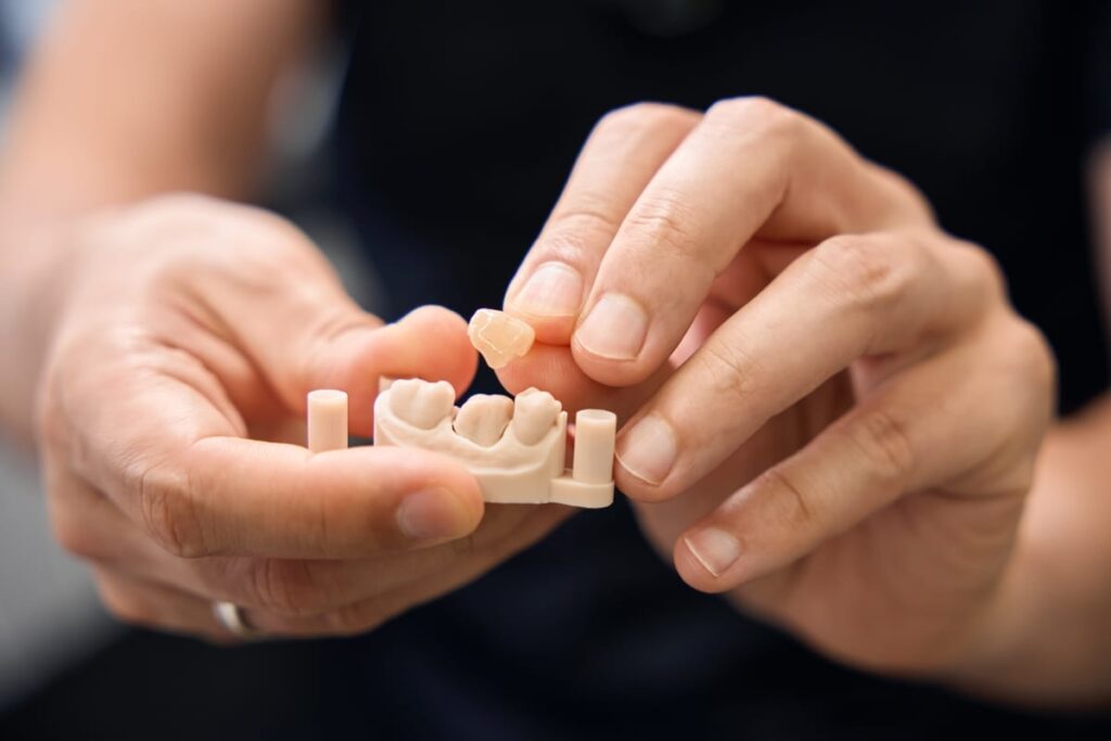 Five Questions About Dental Bridges New Patients Always Ask